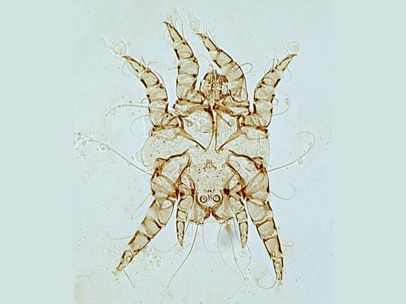 An ear mite seen through a microscope, a pale blunt body with eight jointed legs and long trailing bristles