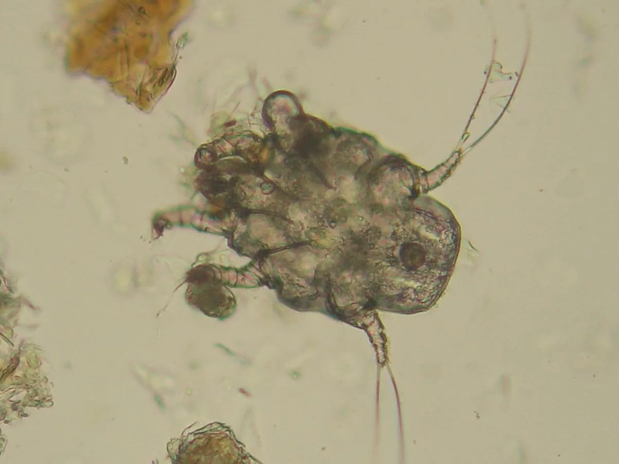 An ear mite lying among dark grainy ear debris on a microscope slide at 100x magnification